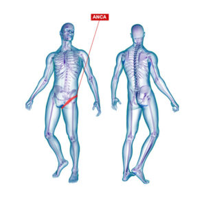 Curare artrosi dell'anca con ozonoterapia lugano