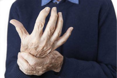 curare artrite reumatoide con ozonoterapia pinerolo