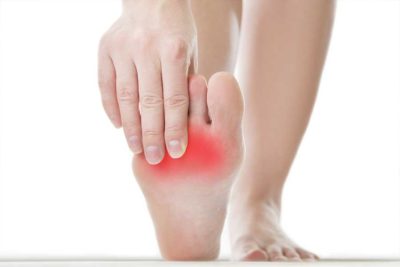 curare fascite plantare con ozonoterapia
